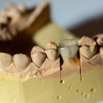 Pediatric Dental Crowns Austin