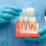 pediatric dental crowns in Austin