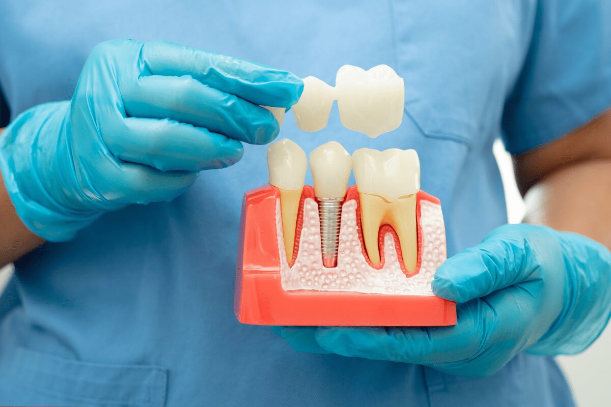 pediatric dental crowns in Austin