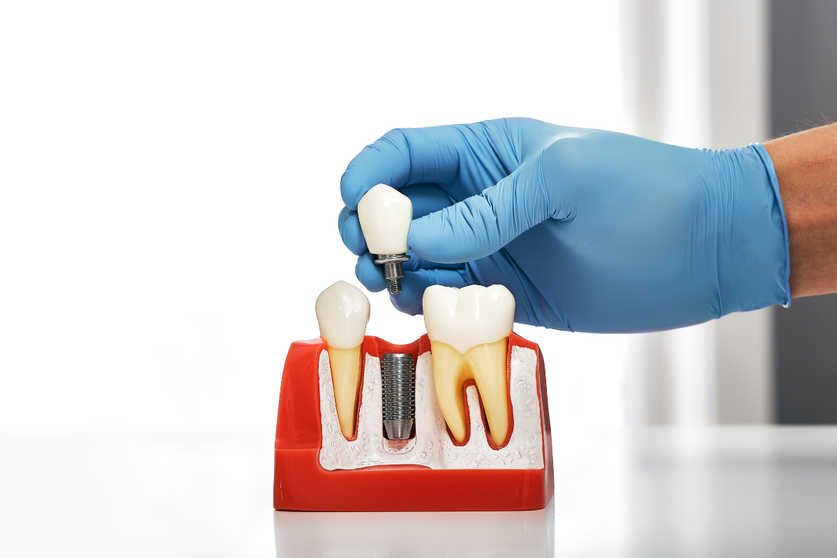 pediatric dental crowns Austin