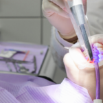 pediatric laser dentistry in Austin