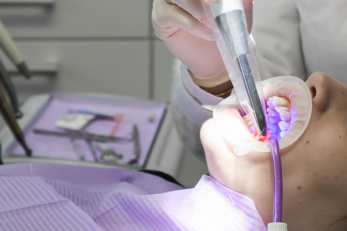 pediatric laser dentistry in Austin